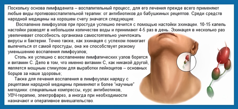 У ребёнка увеличены лимфоузлы на шее: причины, лечение, симптомами каких болезней является