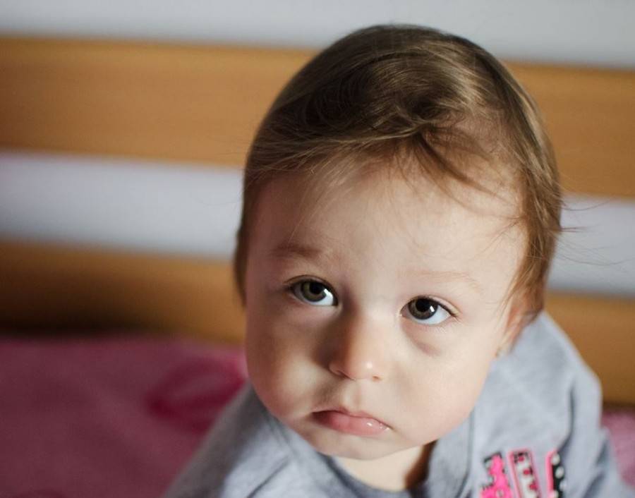 Синяки под глазами у ребенка: причины, лечение - здоровое око | za-rozhdenie.ru