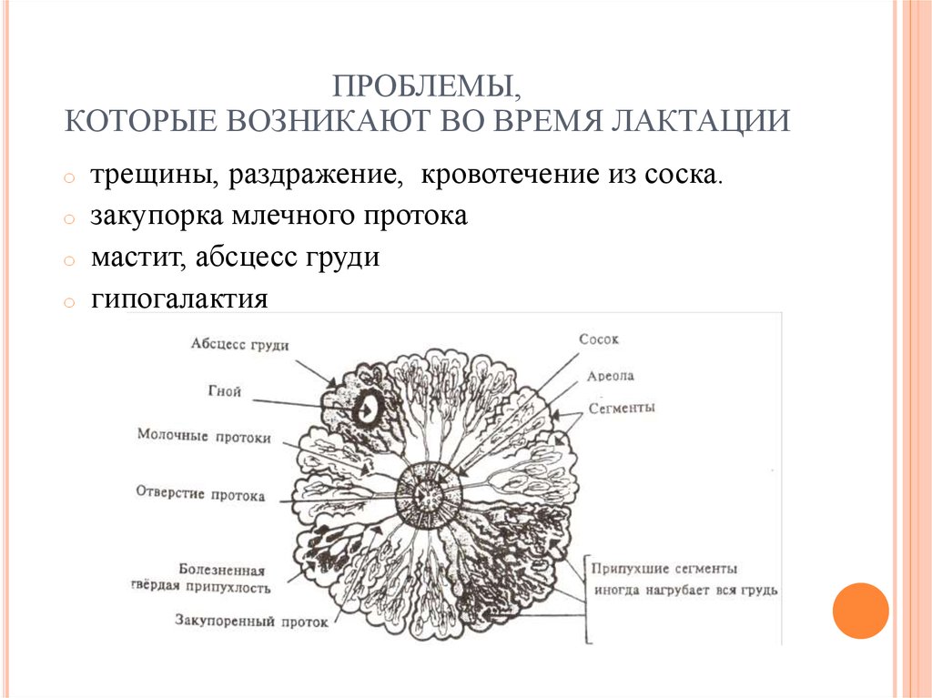 Застой молока у женщин после родов при кормлении грудью: причины и лечение * клиника диана в санкт-петербурге