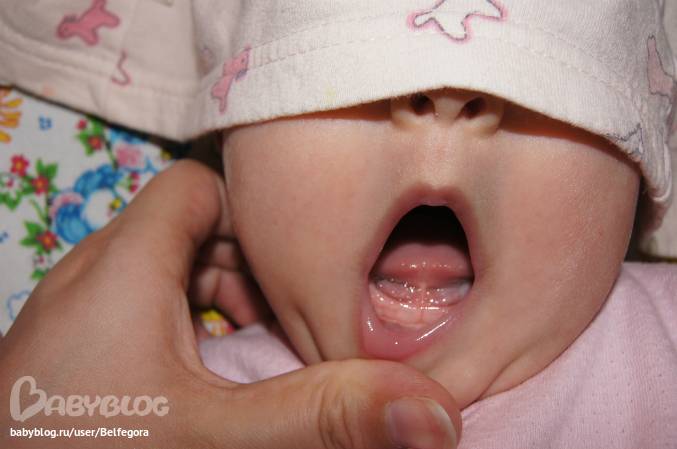 Слюни у трехмесячного ребенка. Слюнявый младенец. Слюни у 2 месячного грудничка. Могут ли лезть зубы в 2 месяца.