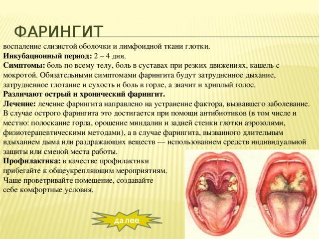 Ангина у грудничка, основные симптомы и лечение ангины у детей до года