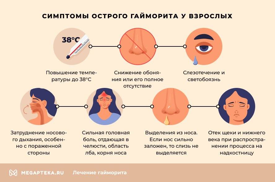 Гайморит при беременности - симптомы, диагностика и чем лечить