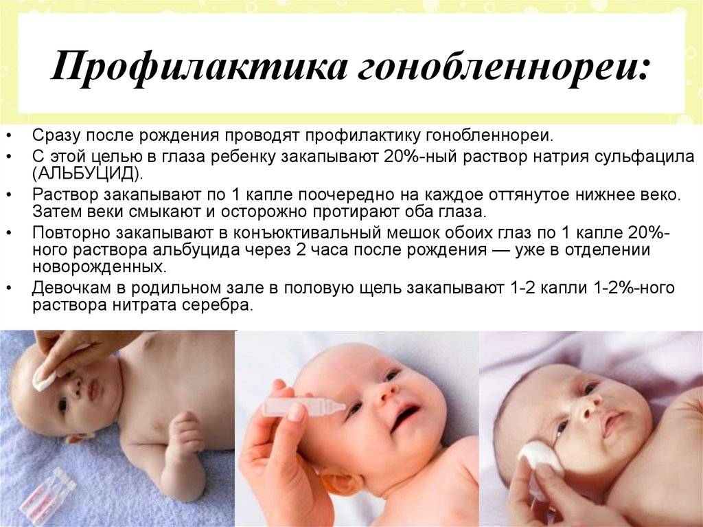 Профилактика простуды у детей до года
