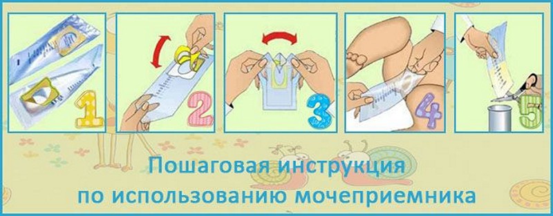 Как у девочки и мальчика грудничка собрать мочу: способы сбора анализа мочи у новорожденных детей / mama66.ru