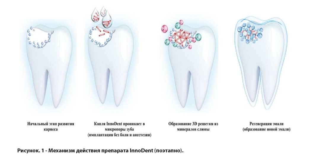 Правда ли, что из-за грудного молока может возникнуть кариес у детей?