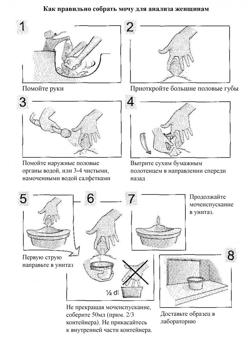 Сдача анализа мочи и кала. Как собрать кал на анализ. Анализ кала как правильно собрать. Как правильно сдать анализ кала. Как собрать кал на анализ у ребенка.