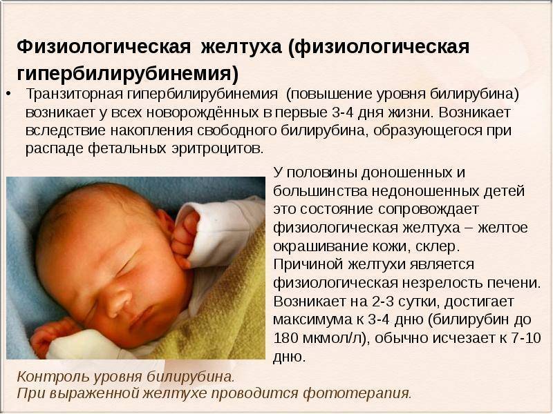Желтуха у новорожденных: откуда берется и что делать?