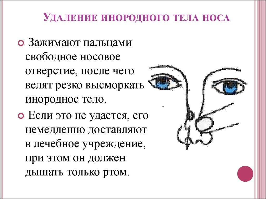 Что делать при попадании инородного тела в нос ребёнку? Рекомендации врача для родителей