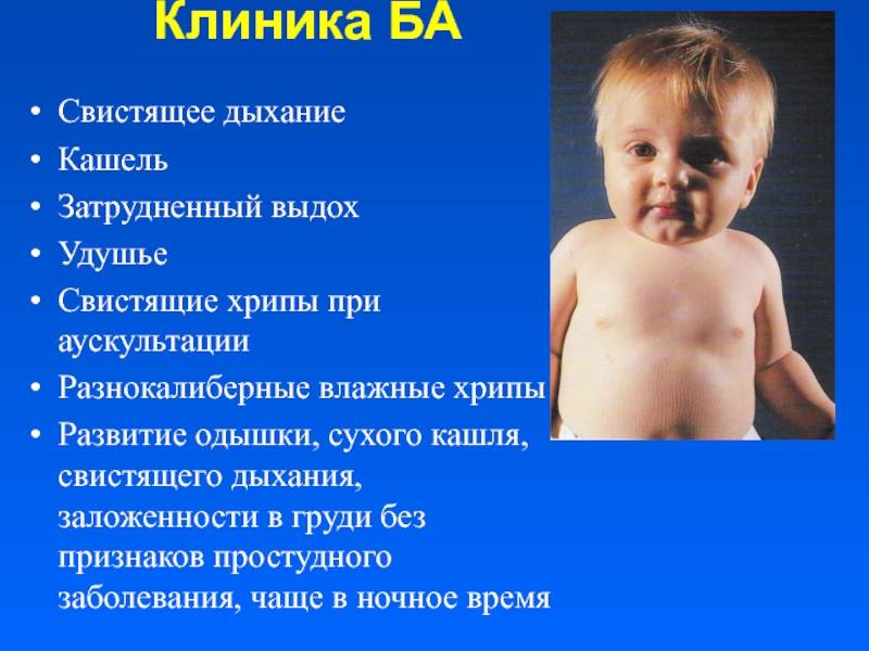 Затруднённое дыхание у ребёнка (трудно дышать): 7 вероятных причин от врача-педиатра