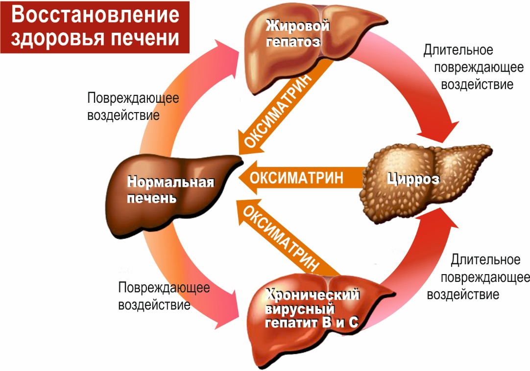 Фиброз печени: лечение, степень, диагностика