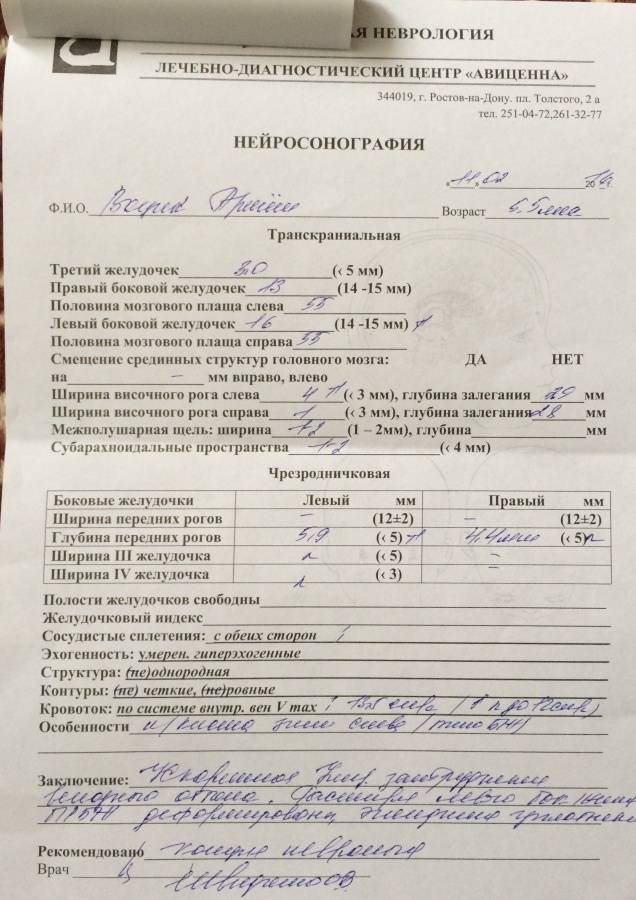 Нейросонография новорожденных: когда назначают, что показывает, расшифровка и нормы