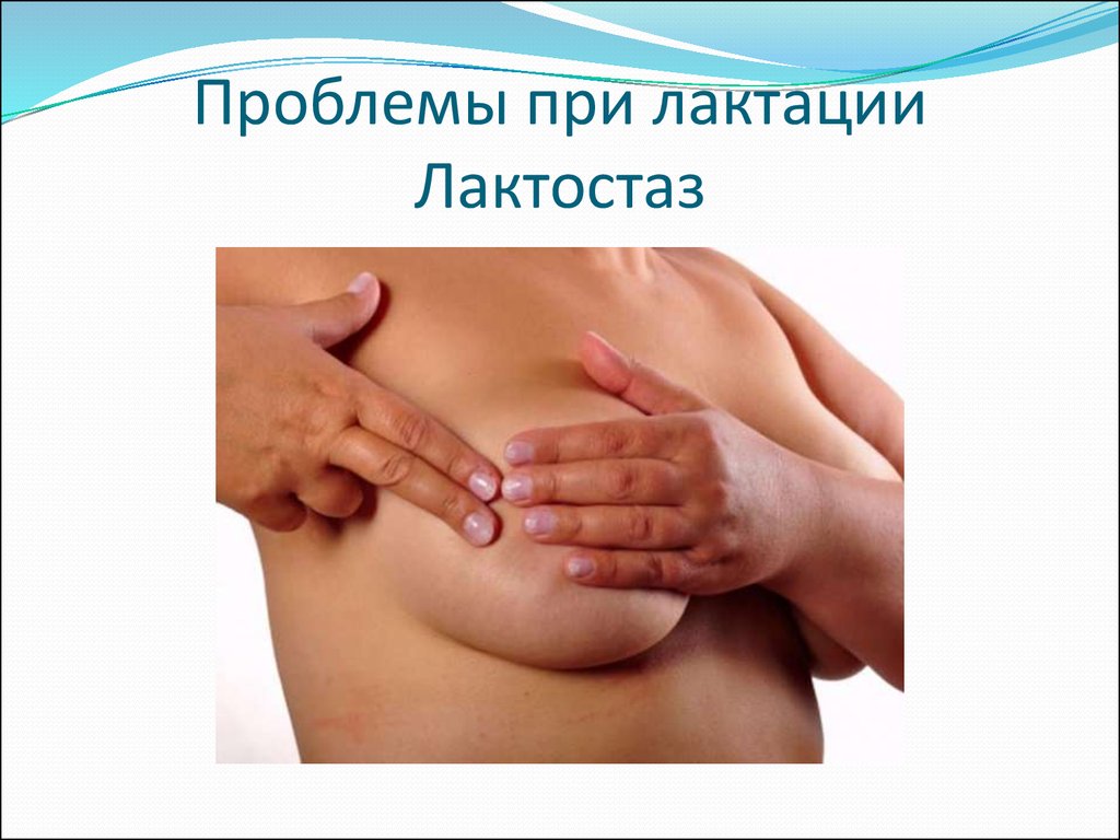 Застой молока - что делать