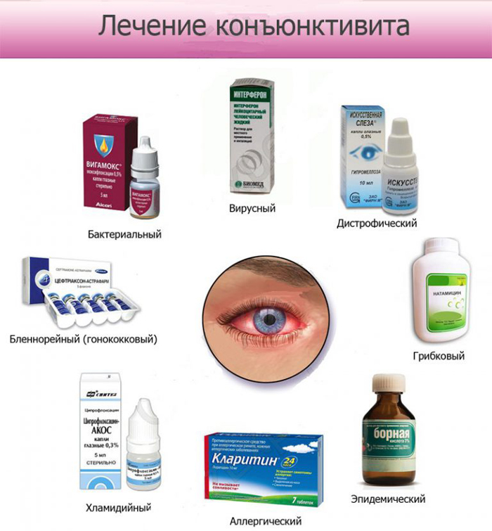 Конъюнктивит у новорожденного и грудничка: чем лечить в домашних условиях, симптомы вирусной, бактериальной и аллергической формы, причины заболевания, лечение