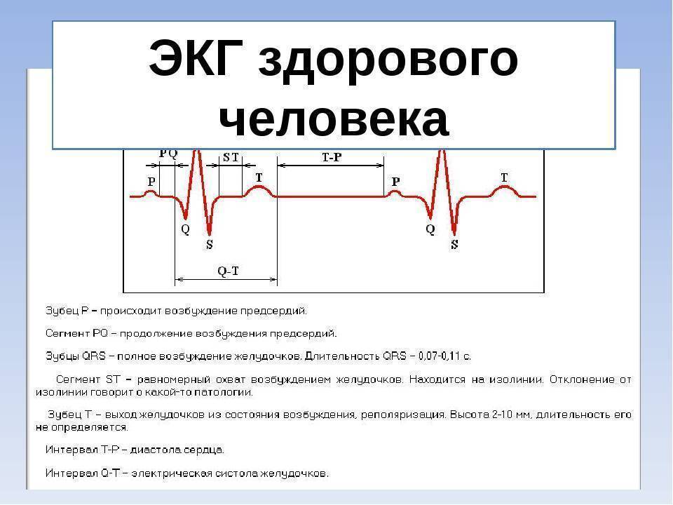 Расшифровка экг — норма и отклонения, выявление патологий
