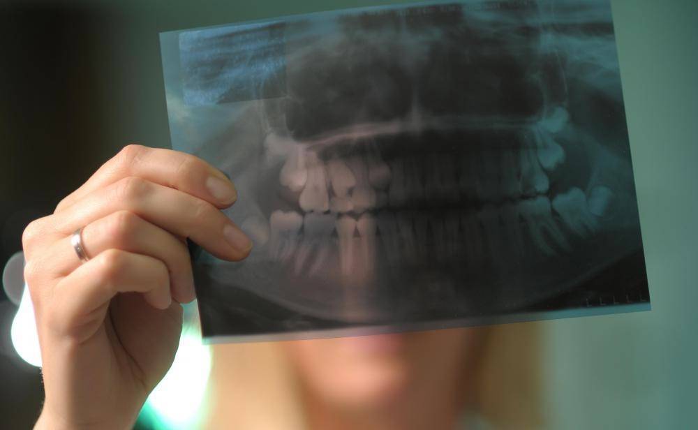 Можно ли делать снимок зуба при беременности | на ранних и поздних стадиях