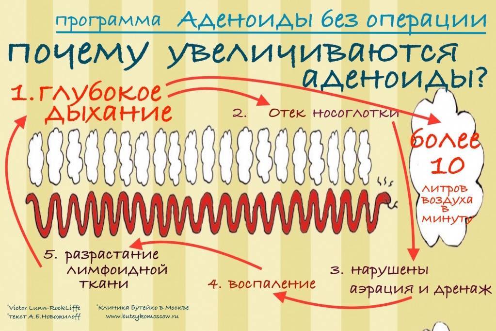Лечение хронического аденоидита