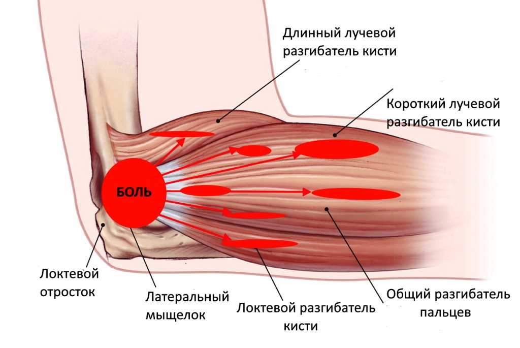 Симптомы и лечение сыпи на локтях и коленях у ребенка