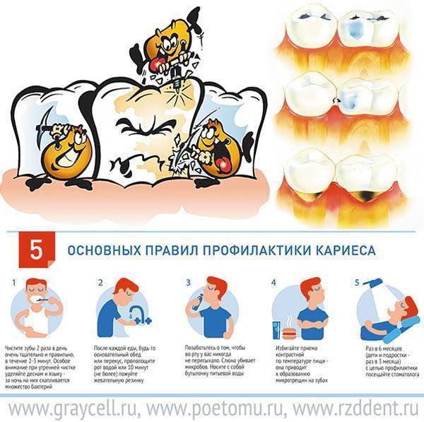 Грудное вскармливание и кариес.