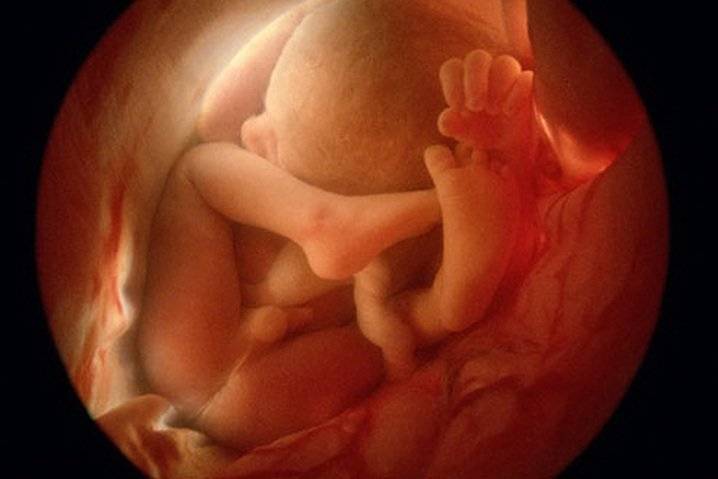 36 неделя беременности. календарь беременности   | материнство - беременность, роды, питание, воспитание