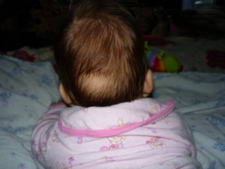 Причины облысения затылка младенца: почему стираются волосы у новорожденного