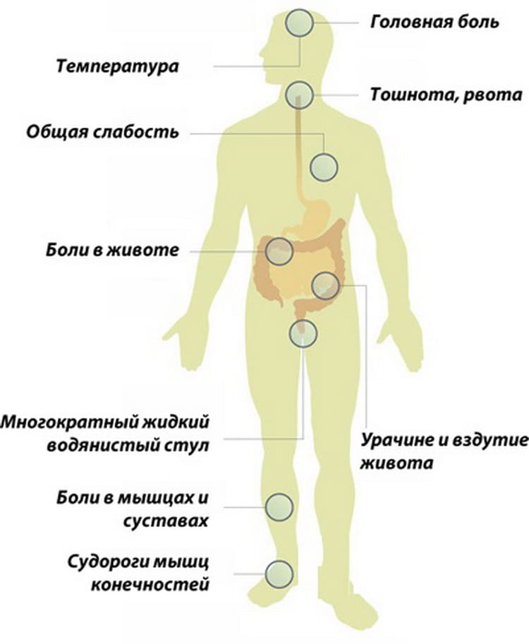 Инкубационный период сальмонеллеза у взрослых. Основные симптомы сальмонеллеза. Сальмонеллы симптомы заболевания. Салсальмонеллёз симптомы. Сальмонеллез симптомы у взрослых.