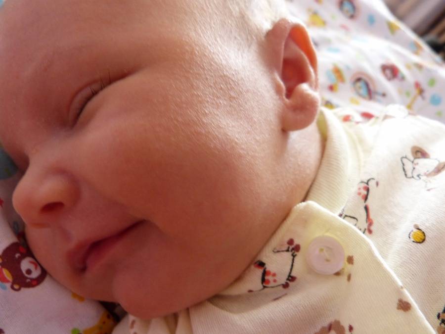 6 наиболее частых причин появления белых прыщиков на лице у новорожденного