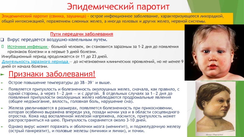 Паротит