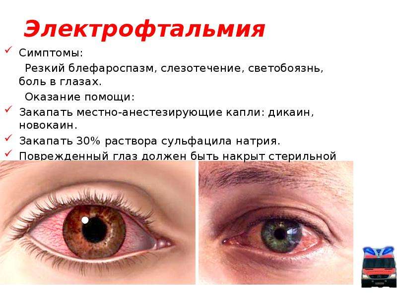 Красные глаза у ребенка: причины, симптоматика и методы лечения - "здоровое око"