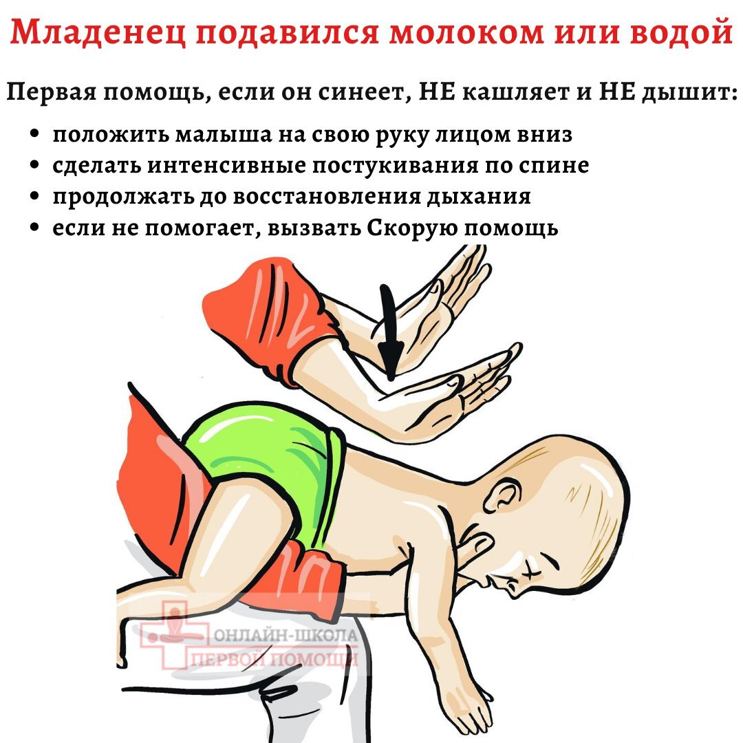 Что делать, если грудничок подавился грудным молоком и задыхается, первая помощь младенцу