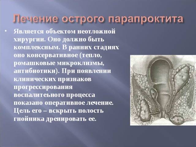 Парапроктит у грудничков и детей старшего возраста: симптомы, причины и лечение, когда нужна операция