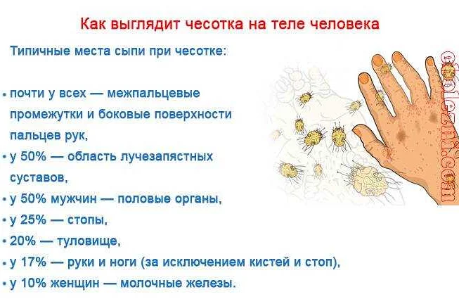 Чесотка симптомы у детей фото и лечение