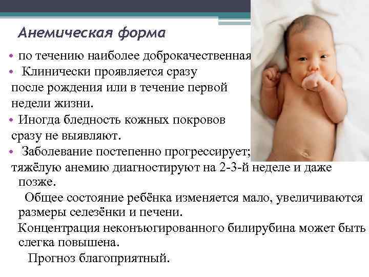 Анемия у грудного ребенка: причины, симптомы и лечение | prof-medstail.ru