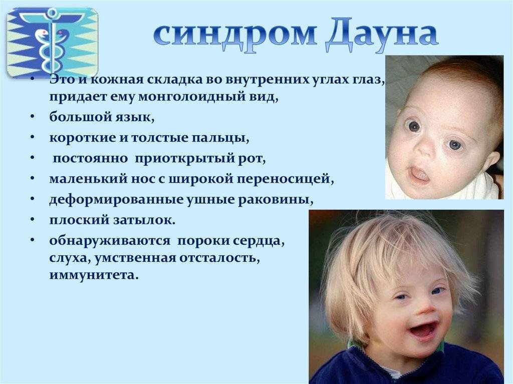 Ребенок закатывает глаза вверх или в сторону, когда засыпает или спит - почему это происходит?