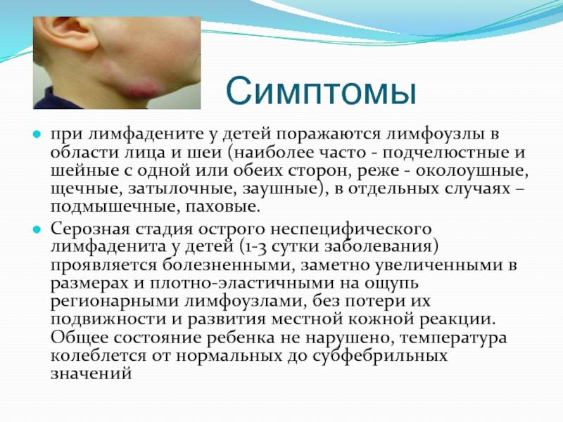 Как лечить воспаление узел Причины увеличения заушных лимфоузлов у детей: признаки лимфоденита, как лечить
