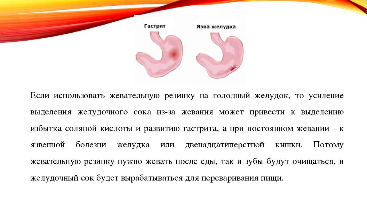 Что поможет вам облегчить симптомы гастрита при беременности?