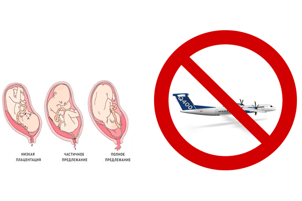 Можно ли беременным летать на самолете - ограничения и поведение в полете