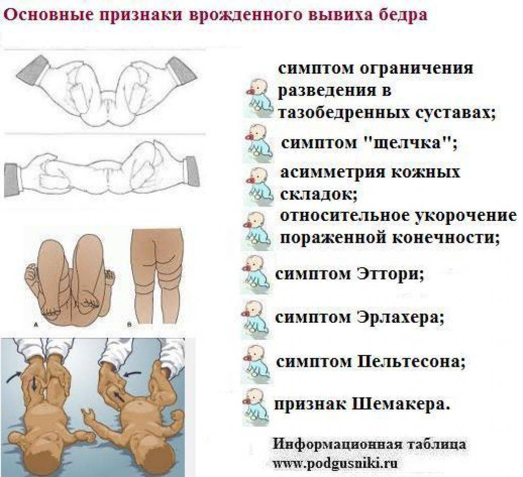 Дисплазия тазобедренного сустава