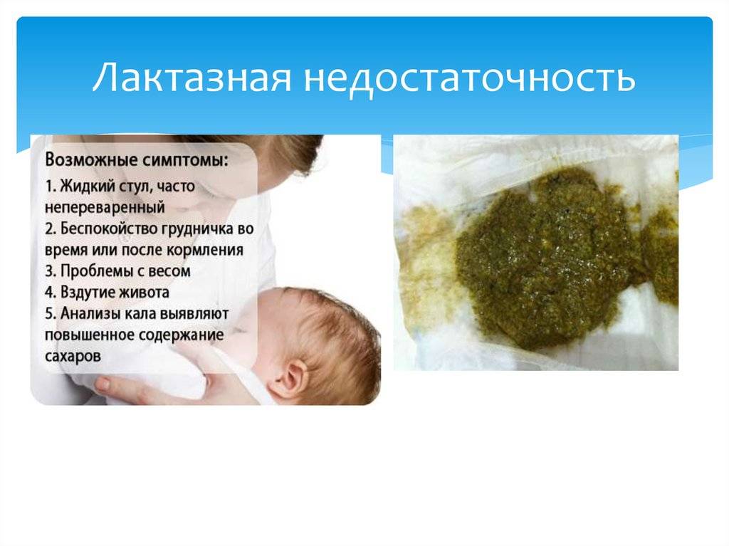 Лактазная недостаточность у ребенка: причины, последствия, лечение 