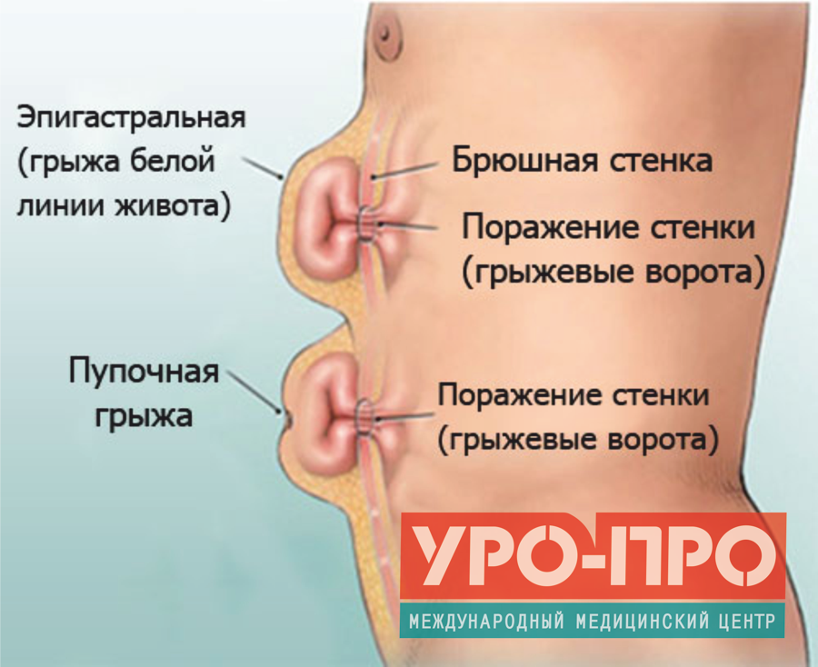 Ребенок периодически жалуется на боль в животе, ребенок жалуется на боль в животе. - отзывы и жалобы