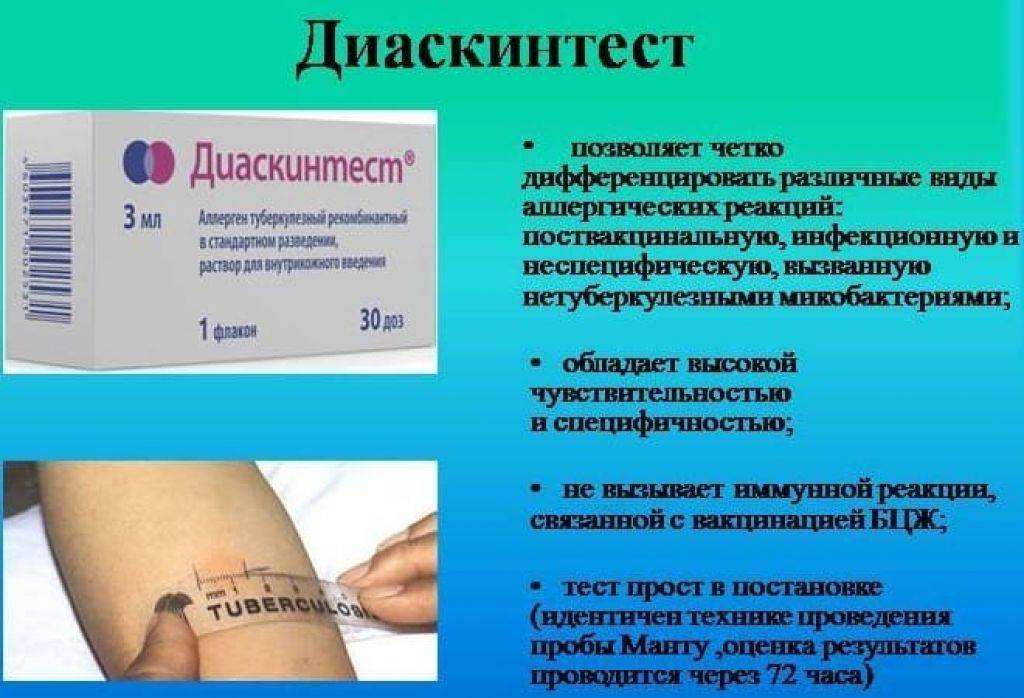 Что делакть когда нет реакции на манту у ребенка