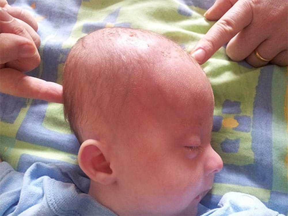 1.5 месяца ребенку тело горячее лоб холодный. у грудничка горячая голова, а лобик холодный