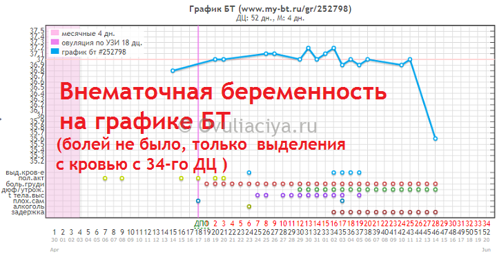 Что делать, если при беременности поднялась температура?
