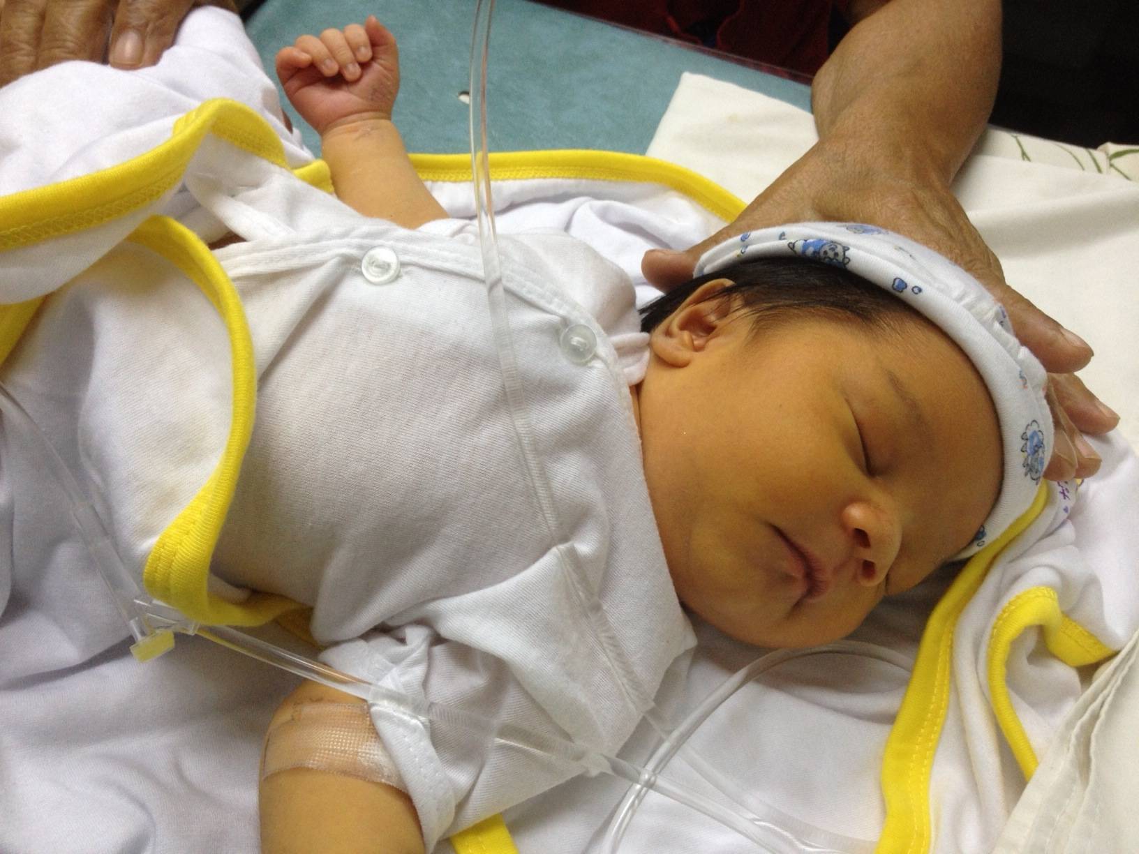 Как диагностировать желтуху новорожденных - советы педиатра