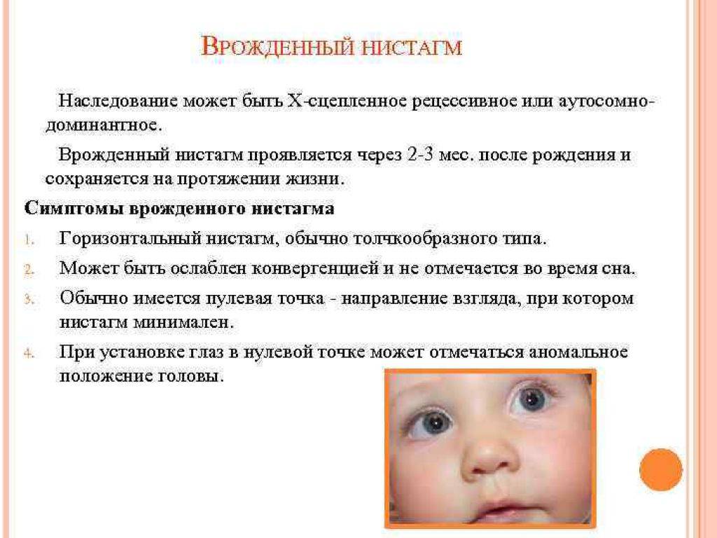 Как определить косоглазие у ребенка до года: причины, лечение и фото