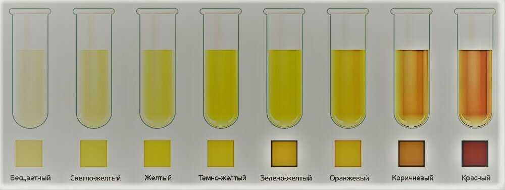 Бесцветная моча у ребенка, желтая или оранжевая: возможные причины и варианты нормы