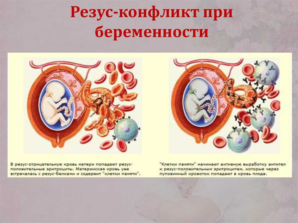 Несовместимость групп крови при зачатии: что нужно знать