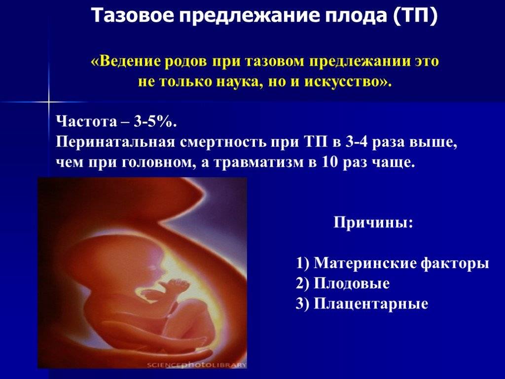 Тазовое предлежание плода: классификация, особенности, причины, ведение беременности и способы родов