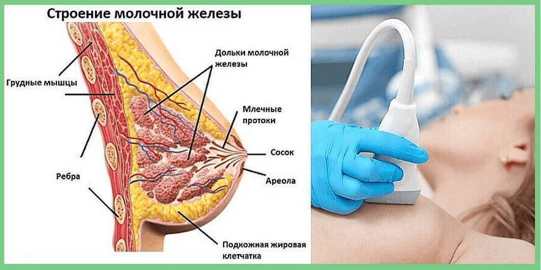 Узи молочных желез