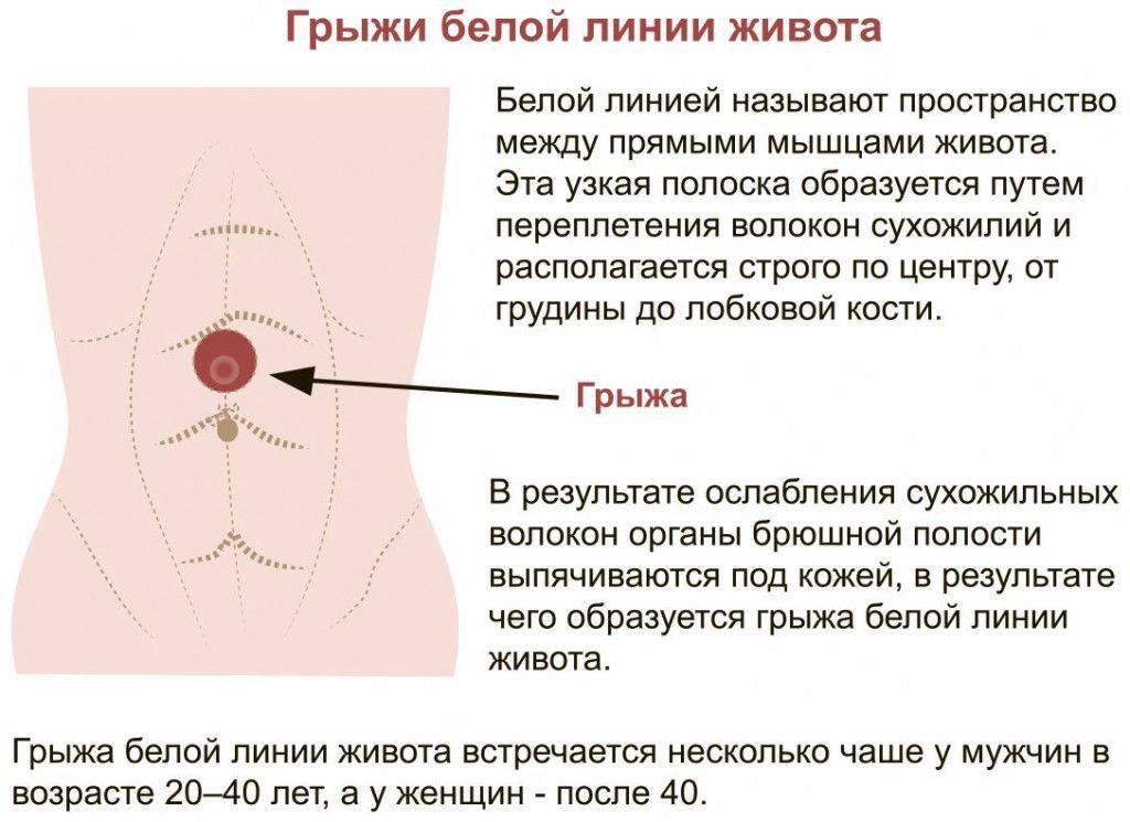 Почему у ребенка болит живот в области пупка: причины и первая помощь