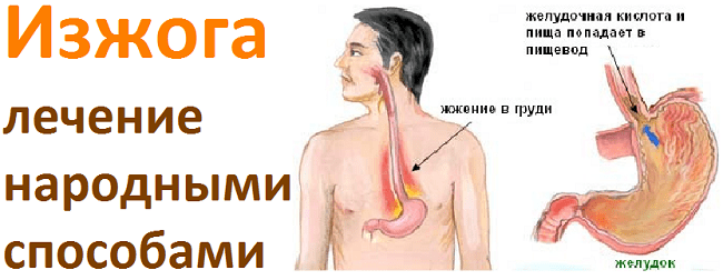 Причины и лечение изжоги у ребенка